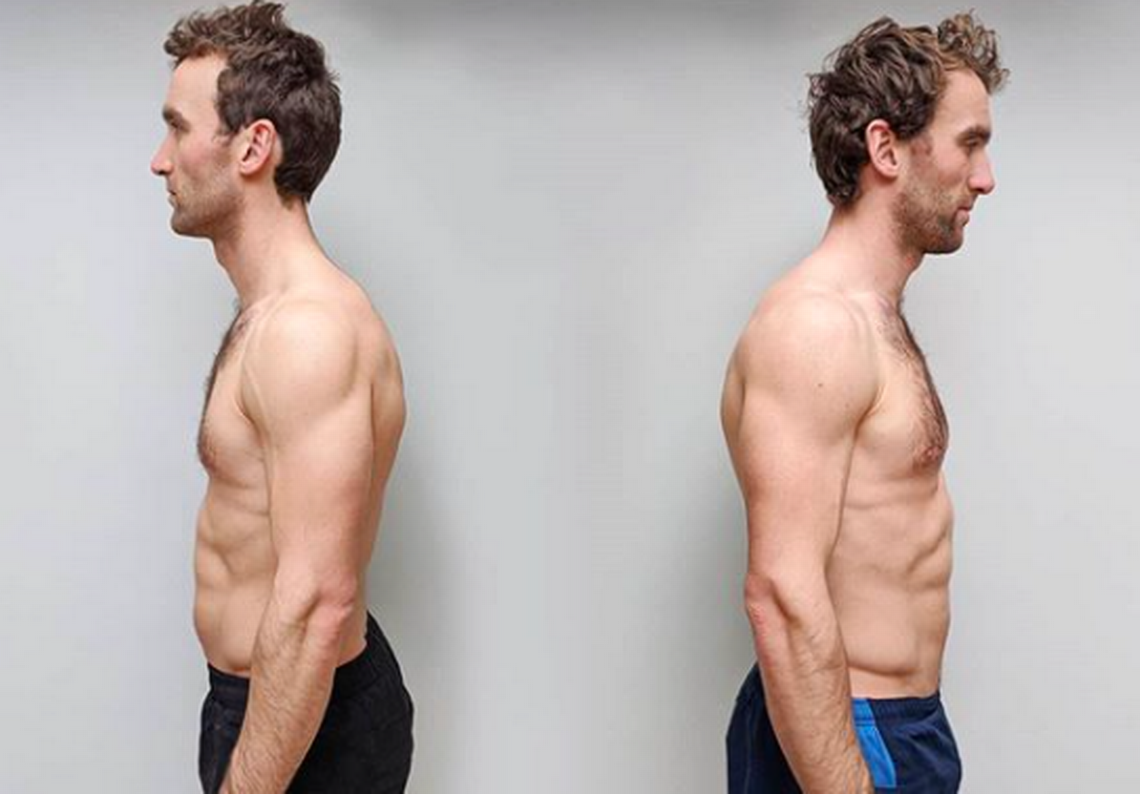 5 Kilos De Grasa Vs 5 Kilos De Musculo Dieta vegana vs. carnívora: gemelos realizan experimento para determinar la  opción más saludable | 24horas